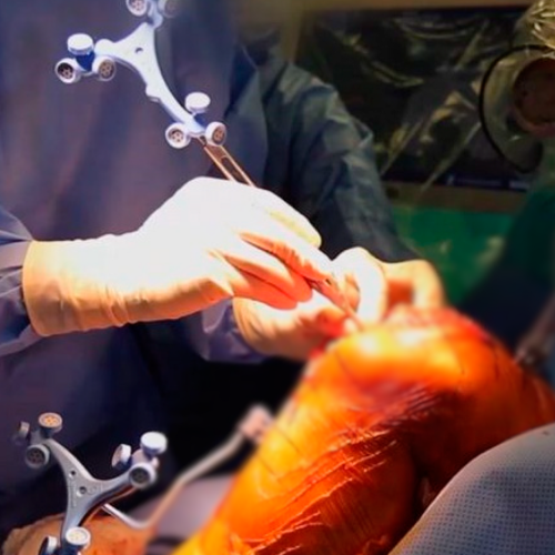 Knee Surgery