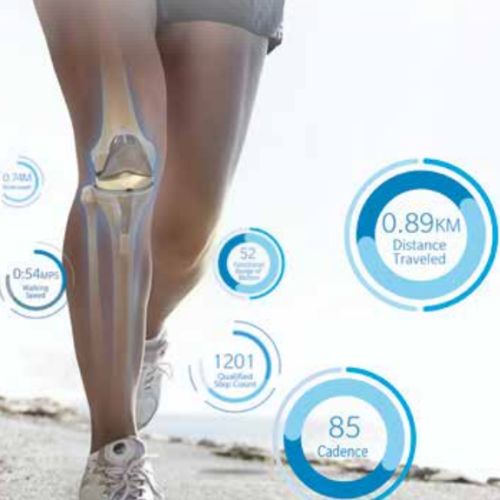 PIQ Knee